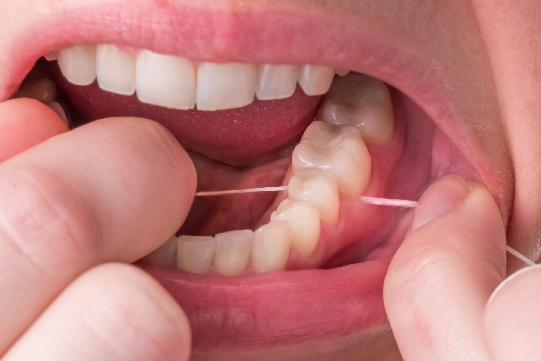 OC_ELGYDIUM CLINIC_Dental Floss_Application_Teeth_2_2019